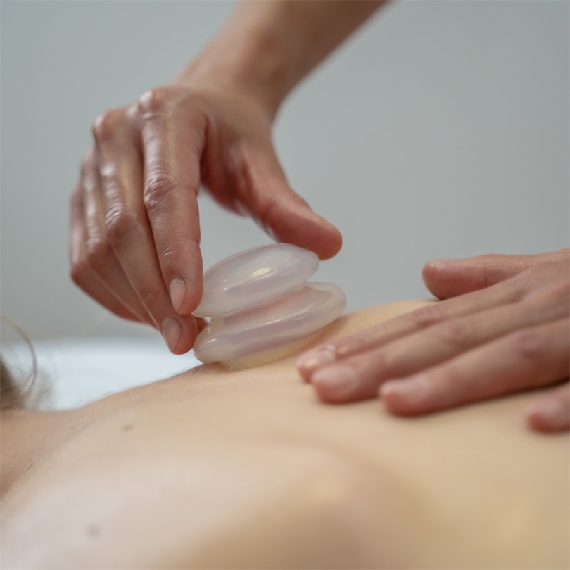 cupping massage on back